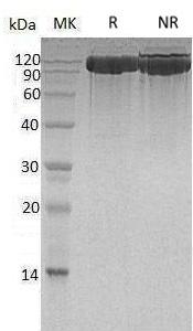 Human ACE2/UNQ868/PRO1885 (His tag) recombinant protein
