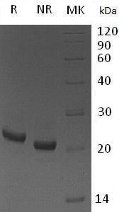 Mouse Lcn2 (His tag) recombinant protein