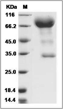 Rat CD133 / PROM1 / Prominin 1 Protein (Fc Tag) SDS-PAGE