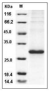 Human RhoA Protein (His Tag) SDS-PAGE