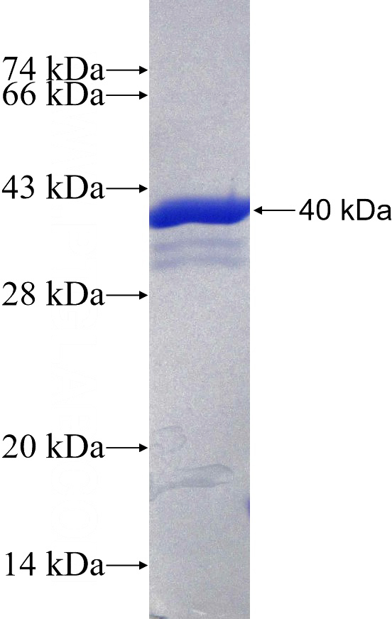 Recombinant Human TRPS1 SDS-PAGE