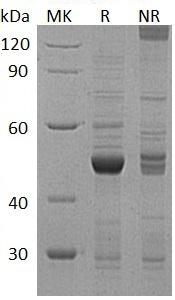 Human ZIK1/ZNF762 (T7 tag) recombinant protein