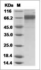 Influenza A H3N2 (A/Sydney/5/1997) Hemagglutinin / HA Protein (His Tag)