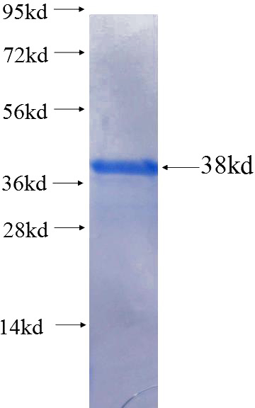 Recombinant Human FLVCR1 SDS-PAGE