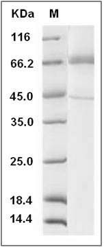 Human TLR4 / CD284 Protein (His Tag) SDS-PAGE