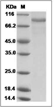 Canine EGFR / HER1 / ErbB1 Protein (His Tag) SDS-PAGE