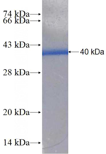 Recombinant Human GRIA1 SDS-PAGE