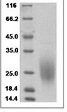 Human GM-CSF/CSF2 Protein 15484