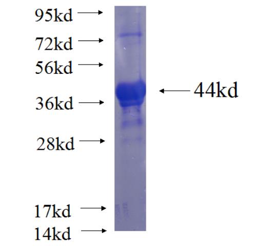 Recombinant human ACD SDS-PAGE