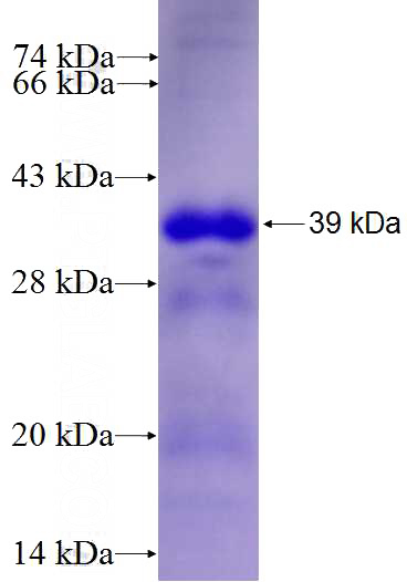 Recombinant Human TRAF4 SDS-PAGE