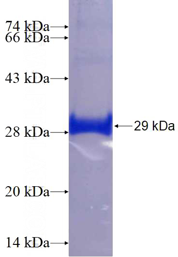 Recombinant Human KCND2 SDS-PAGE