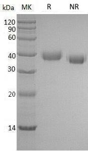 Human AZU1 (His tag) recombinant protein