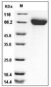 Influenza A H5N1 (A/Japanese white-eye/Hong Kong/1038/2006) Hemagglutinin / HA Protein (His Tag) SDS-PAGE