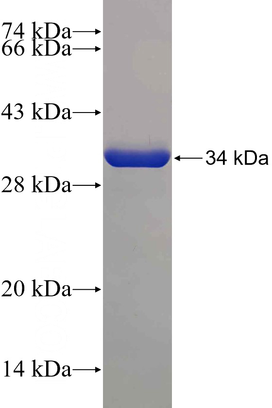 Recombinant Human DYNLL2 SDS-PAGE
