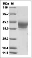 Rat B7-H6 / B7H6 / NCR3LG1 Protein (His Tag)