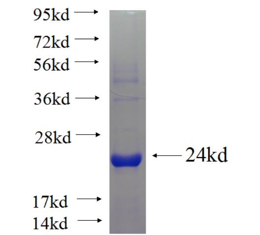 Recombinant human C19orf54 SDS-PAGE