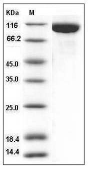Mouse TLR3 / CD283 Protein (His Tag) SDS-PAGE