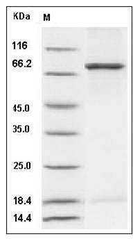 Mouse NEK3 Protein (His & GST Tag) SDS-PAGE