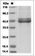 Rabbit IL12B / IL-12B Protein (His Tag)