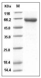Mouse Dkk-3 / DKK3 Protein (His Tag) SDS-PAGE