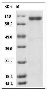 Human Thyroid peroxidase / TPO Protein (257 Ser/Ala, 725 Pro/Thr, His Tag) SDS-PAGE