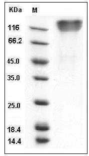 Human OMGP / OMG Protein (aa 1-416, His Tag) SDS-PAGE