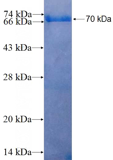 Recombinant Human KRT19 SDS-PAGE