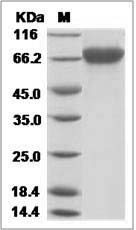 Influenza B (B/Malaysia/2506/2004) Hemagglutinin / HA Protein (His Tag)