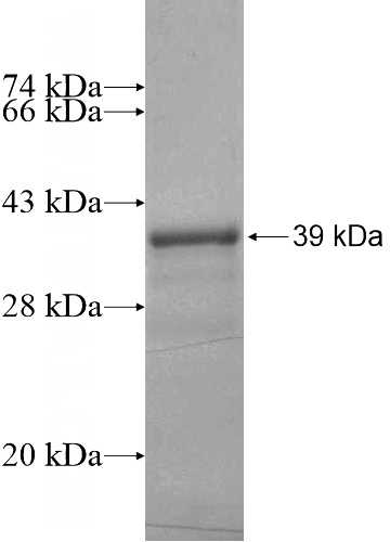 Recombinant Human ZNF816A SDS-PAGE