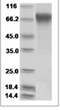 H1N1 HA Protein 14968