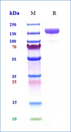 Human ACE2 Protein (Fc Tag)