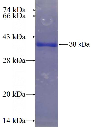 Recombinant Human WDR69 SDS-PAGE
