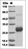 Ebola virus EBOV (subtype Bundibugyo, strain Uganda 2007) VP24 Protein (His Tag)