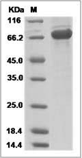 Human AKT2 / Protein kinase B ? / PKB beta Protein (His & GST Tag) SDS-PAGE