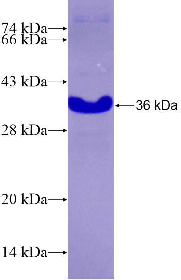 Recombinant Human MEIS2 SDS-PAGE