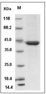 Mouse Serpinb6b Protein (His Tag) SDS-PAGE