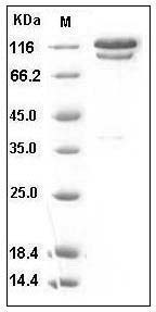 Human C2 / Complement Component 2 Protein (Fc Tag) SDS-PAGE