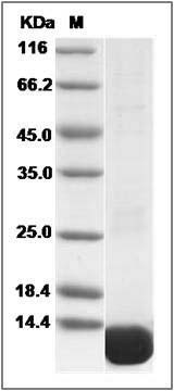 Human S100A4 Protein (His Tag) SDS-PAGE