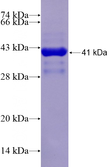 Recombinant Human BSEP SDS-PAGE