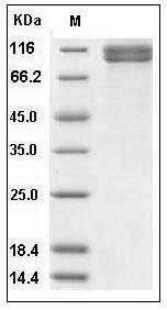 Human IL27Ra / TCCR / WSX1 Protein (Fc Tag) SDS-PAGE