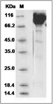 Mouse Contactin 1 / CNTN1 Protein (His Tag) SDS-PAGE