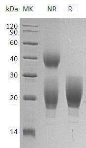 Mouse Ctla4/Cd152 (His tag) recombinant protein