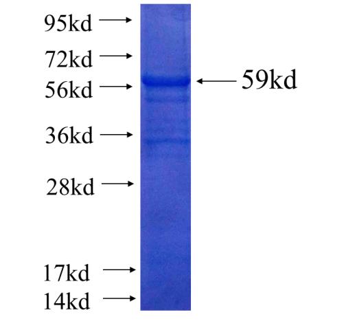 Human SNX17 Recombinant protein (GST tag)