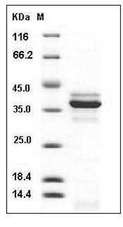 Mouse Cathepsin L / CTSL Protein (His Tag) SDS-PAGE