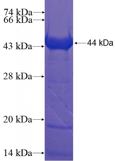 Recombinant Human CCDC37 SDS-PAGE