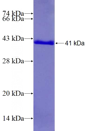 Recombinant Human RPS12 SDS-PAGE