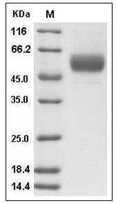 Human Vaspin / SerpinA12 Protein (His Tag) SDS-PAGE