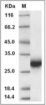 Rat TIMP-1 / TIMP1 Protein SDS-PAGE