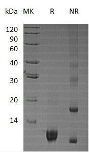 Human NRN1/NRN (His tag) recombinant protein