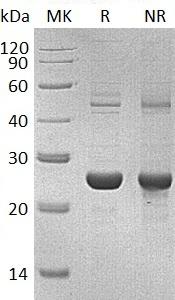Human CTF1 (His tag) recombinant protein
